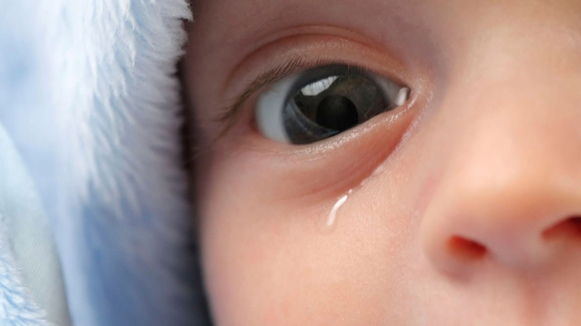 Obstrução de vias lacrimais em bebês Saúde Ocular