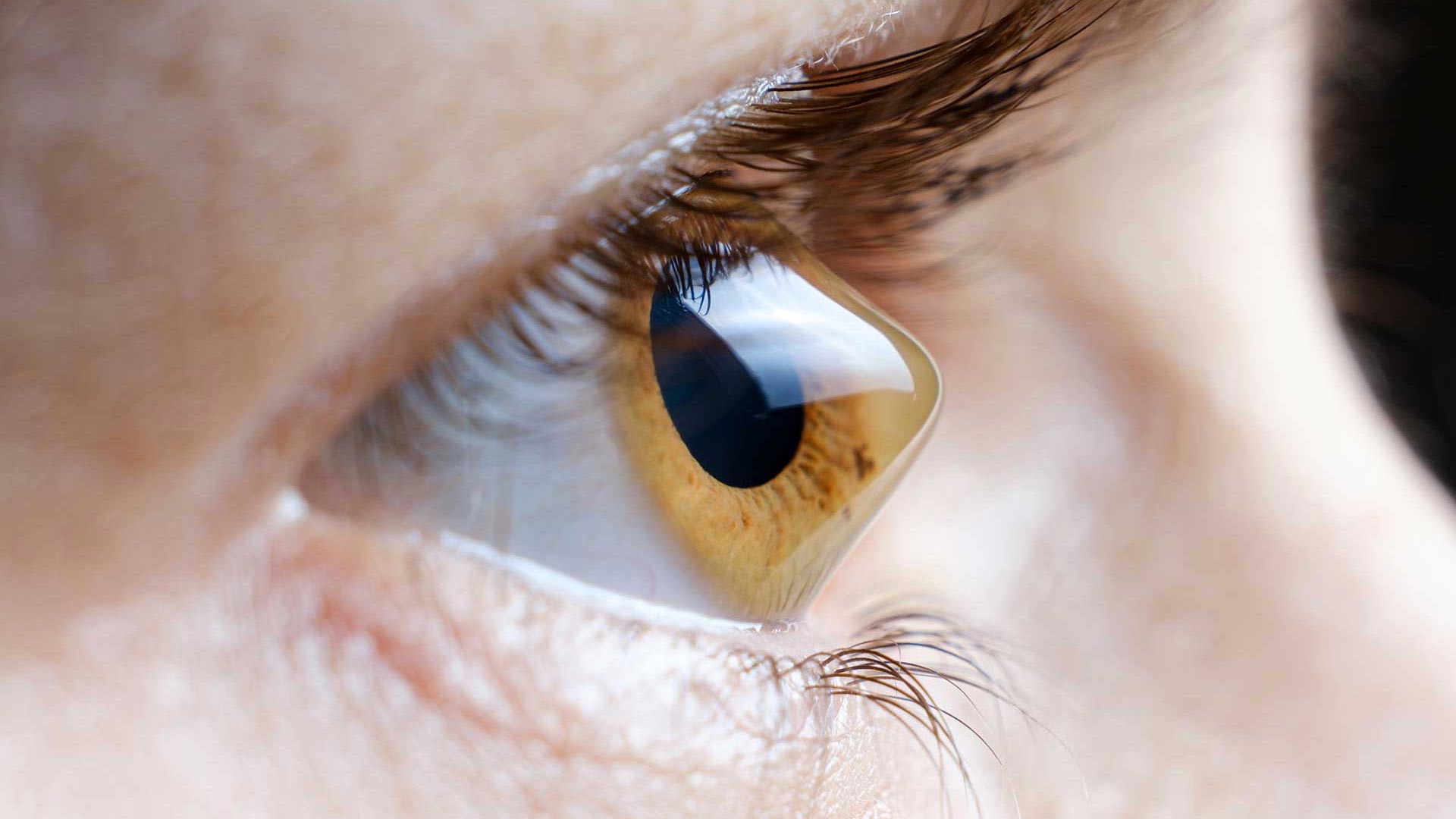 Saúde Ocular Tratamento do Ceratocone