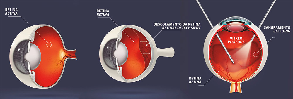 Saúde Ocular Oftalmologia 